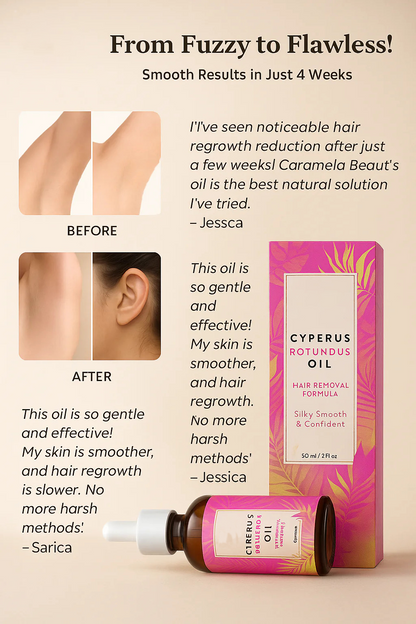 Cyperus Rotundus Oil